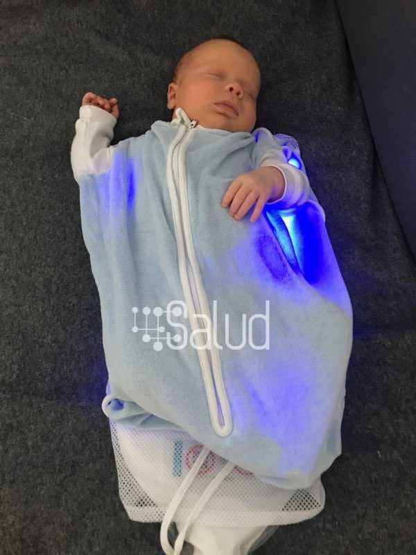 Zdjęcie dziecka w trakcie zabiegu