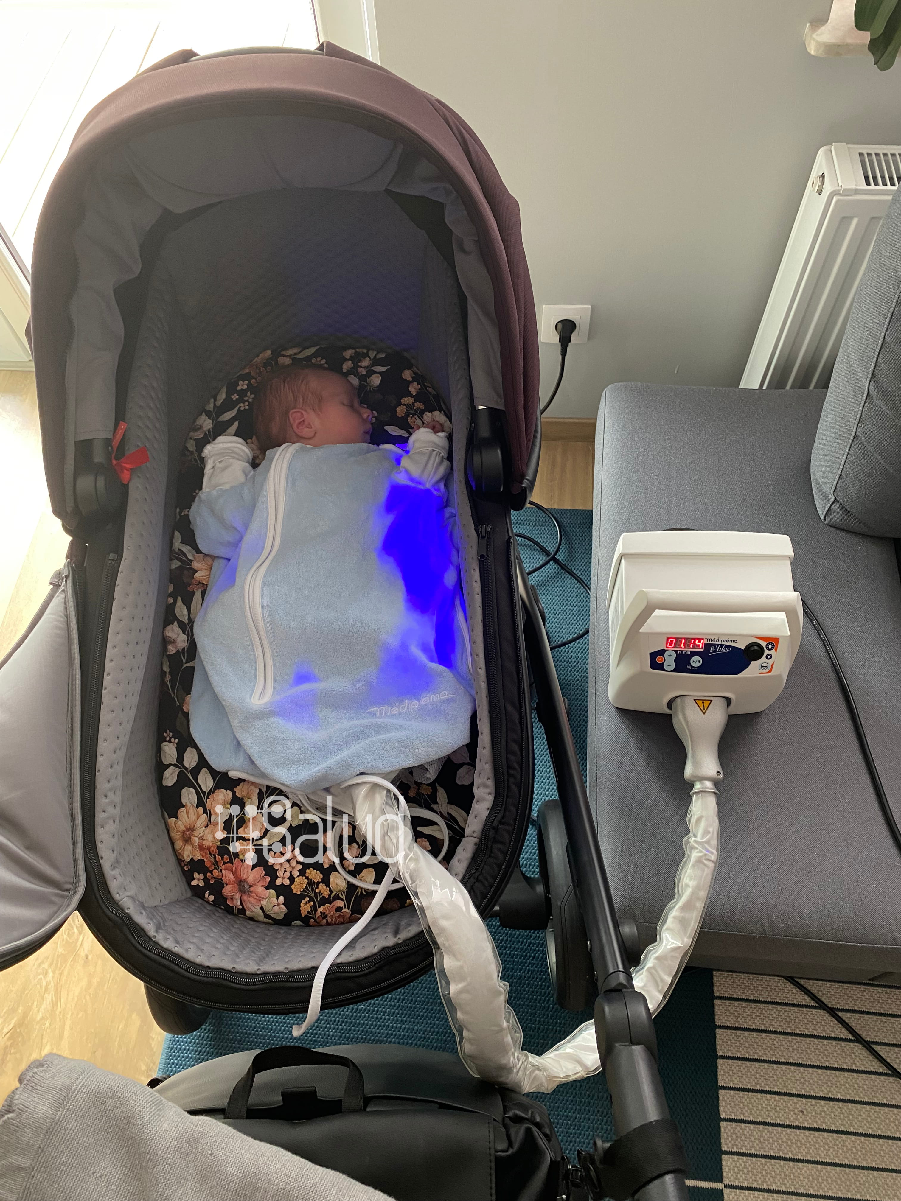 Zabieg wykonywany w trakcie snu w wózeczku